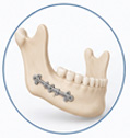 Oral & Maxillofacial Surgery